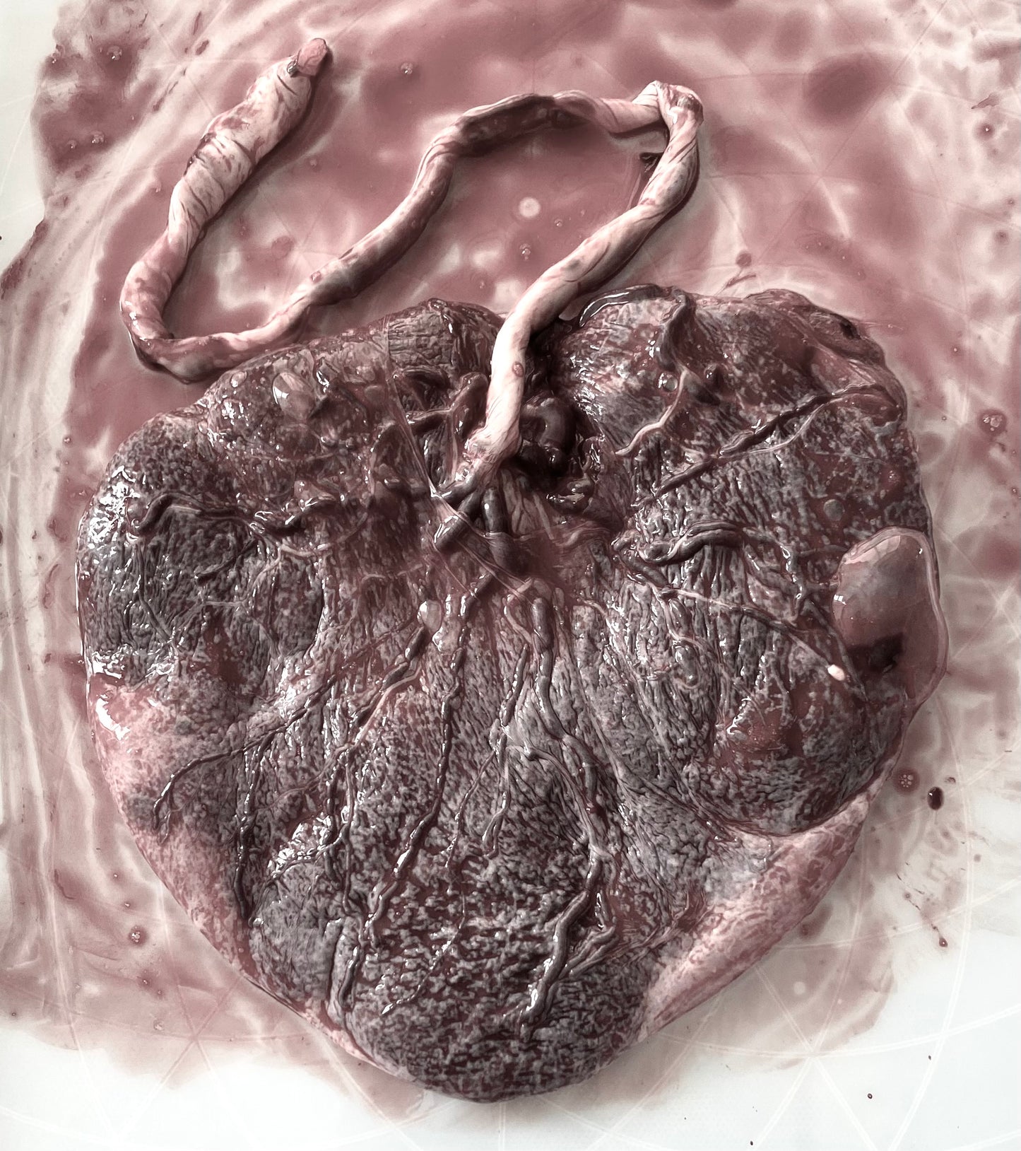 Placenta Prints